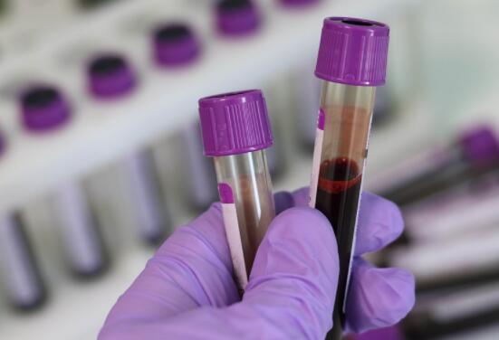 ������Щ����ܼ�����Ե��ϵ������Щ��ⷽ����