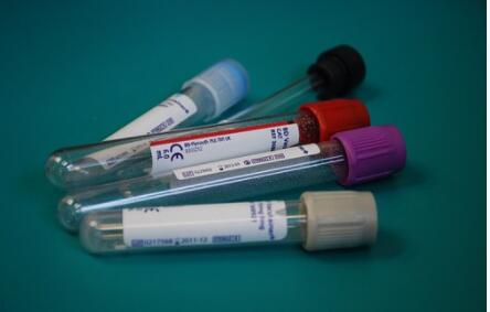 ����̥�����Ӽ����ù󲻹󣿼۸��Ƕ��٣�