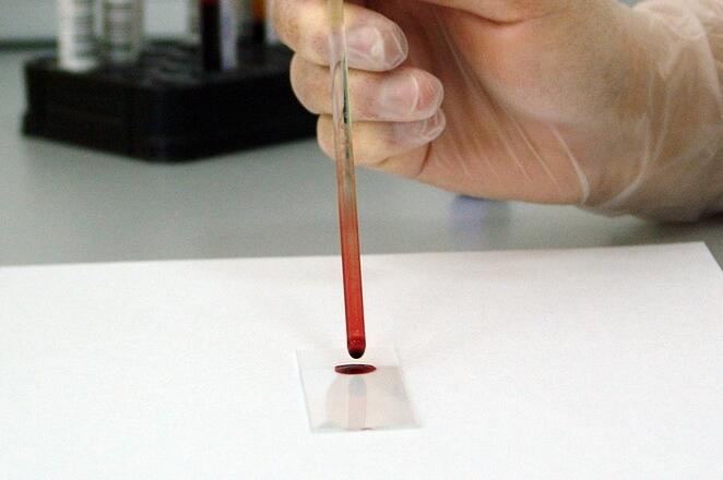 ����̥�����Ӽ��ʲôʱ�����ȽϺã���ʲô������