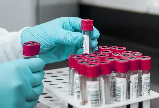 ����������ô֪���뺢�ӵ����ӹ�ϵ���������Ӽ����ô��?